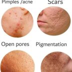Skin & Hair problems solution
